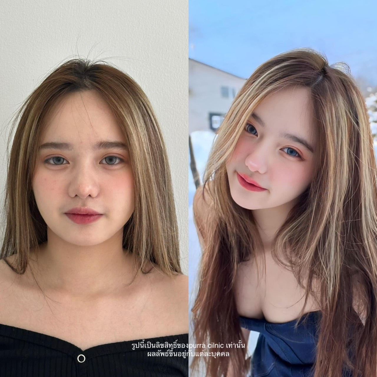 รีวิวแฟต Purra Clinic
